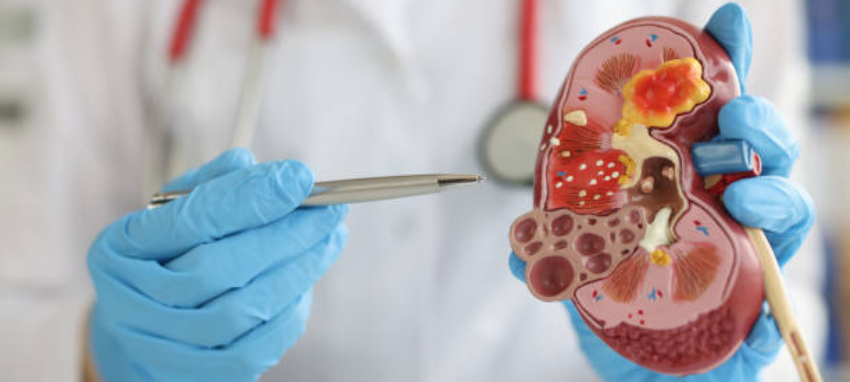 A physician holding a pen & examining the condition of a kidney model while wearing a stethoscope.