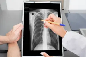 On a tablet, a pulmonologist specialist holds a pen, pointing at an x-ray of the lungs.