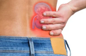 A person grimacing in pain due to kidney discomfort in their back